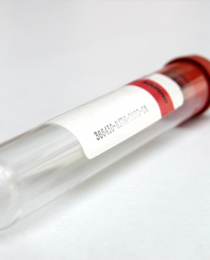 blood sample for lab in a glass vial